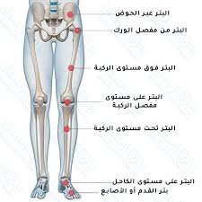 طرف صناعي للقدم