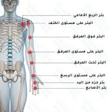 طرف صناعي لليد